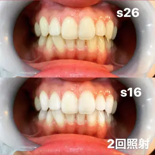 LOVEホワイトニング表参道店所属・LOVE ホワイトニング表参道のその他イメージ