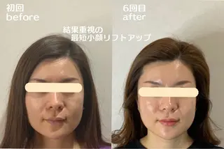 最速小顔・肌質管理 ❣️エスポワールのエステ・リラクイメージ