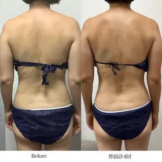 冷却専門店 SLARIのエステ・リラクイメージ