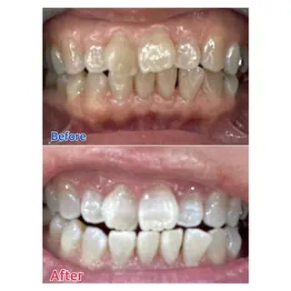 MBEAUTYSALON 千葉店・京成大久保所属・Melty 輝のその他イメージ