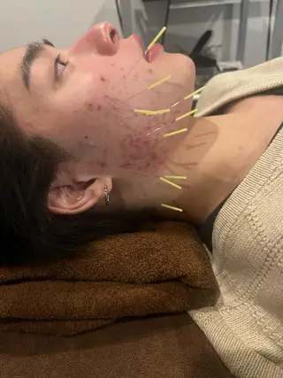 メンズ 美容鍼灸サロン LOMIHARIのエステ・リラクイメージ