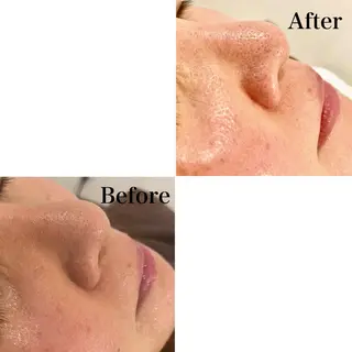 Ｂ&H所属・頭痛•肩こり専門/ 眉サロンB&H心斎橋のエステ・リラクイメージ