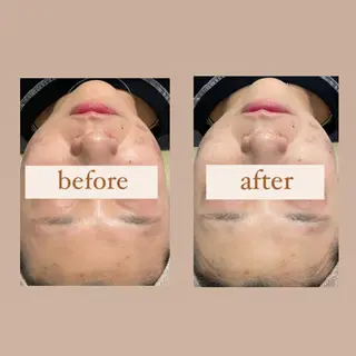 crescent所属・【韓国肌管理・脱毛】 クレセントのエステ・リラクイメージ