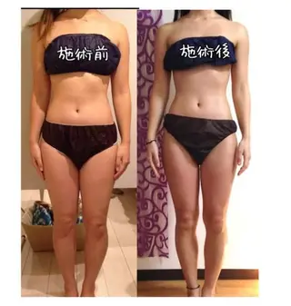 ショート カラー パーマ ヘアアレンジ メンズ キッズ ネイル マツエク・マツパ アイブロウ 強圧オールハンド痩身&黄土よもぎ蒸しプライベートサロンClematis池袋所属・強圧オールハンド痩身 片野のエステ・リラクイメージ