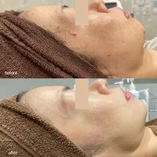 DahliaBeauty ダリアビューティー所属・春日井市Dahlia Beauty　中村のエステ・リラクイメージ