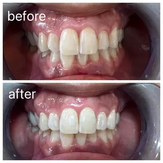 セルフホワイトニング Shineeのエステ・リラクイメージ