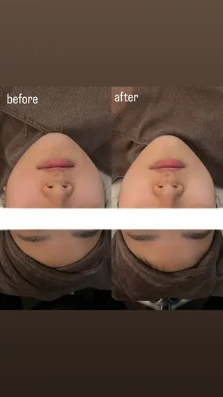 エステサロンino.colore'所属・小顔サロン ino.coloreのエステ・リラクイメージ