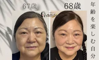 小顔サロンallilin所属・allilin 五所川原　本間のエステ・リラクイメージ