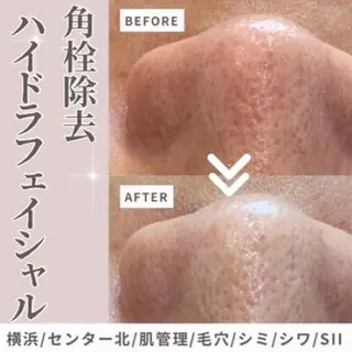 sii センター北 AIのエステ・リラクイメージ