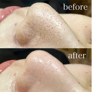 LUANA ルアナのマツエク・マツパデザイン