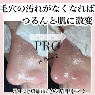 毛穴専門店hula 杉山智美のエステ・リラクイメージ
