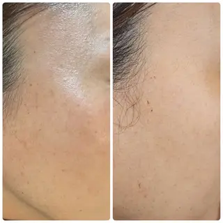 バストアップ専門/ ボディケア/小顔のエステ・リラクイメージ