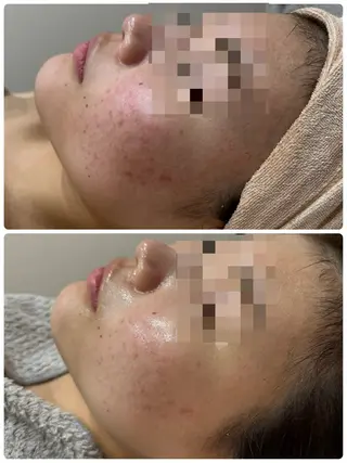 脱毛&フェイシャル 専門店muro.のエステ・リラクイメージ