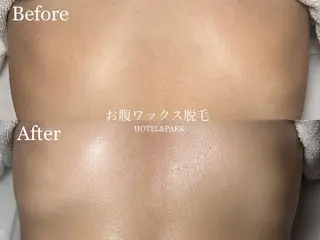 HOTEL&PARK . ワックス脱毛のエステ・リラクイメージ