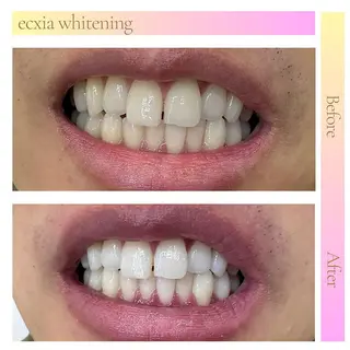 セルフホワイトニング エクシア東上野店のその他イメージ