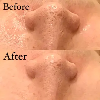 Hari Lounge恵比寿所属・chika🦋 ハリラウンジ恵比寿のエステ・リラクイメージ