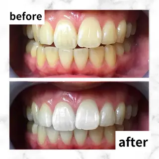 LBSホワイトニング 🌐渋谷店 河内のエステ・リラクイメージ