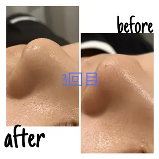 毛穴洗浄・痩身・脱毛 /アルカンジュのエステ・リラクイメージ