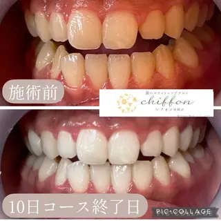歯科レベルの白さ💎 ✨ホワイトニング岡崎のエステ・リラクイメージ