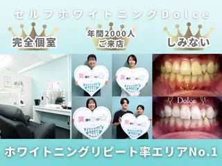 セルフホワイトニング Dolce水戸店のその他イメージ
