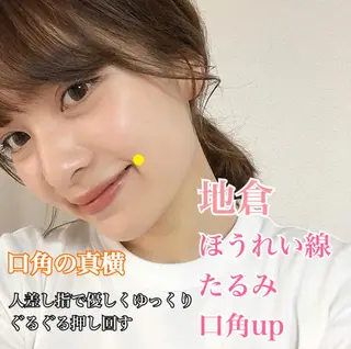 鍼灸整骨院Refine所属・鍼灸 Refineのその他イメージ