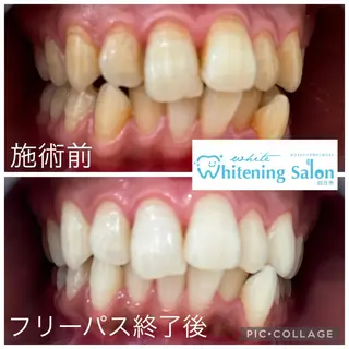 ミディアム メンズ キッズ ネイル マツエク・マツパ ホワイトニング&アイラッシュ四日市ホワイト所属・アイラッシュ ホワイトニング四日市のマツエク・マツパデザイン