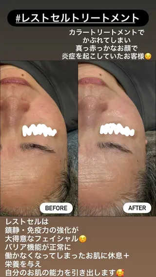 LiZA エステティックサロンのエステ・リラクイメージ