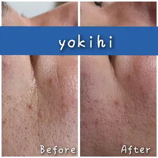 自然由来スキンケア/ 肌質改善/まつパのエステ・リラクイメージ