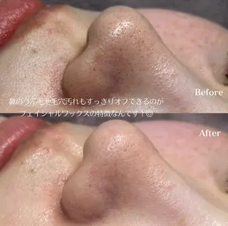 フェイシャルワックス KANAKOのエステ・リラクイメージ