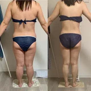 美ボディメイクサロン　only one body所属・桑田 里美のエステ・リラクイメージ