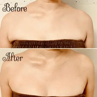 透明感の肌Lino malieのエステ・リラクイメージ