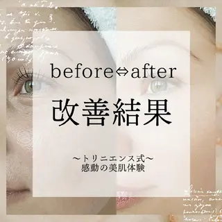 シミケア・肌改善専門 トリニエンス浦和店のエステ・リラクイメージ