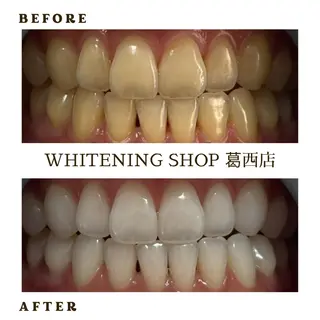 メンズ ホワイトニング ショップ葛西店のその他イメージ