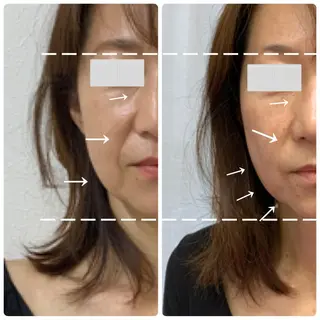 Natsu ＊メンズネイリストのネイルデザイン