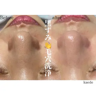 🎀kaede🎀 骨格似合わせ眉毛の眉毛・アイブロウイメージ