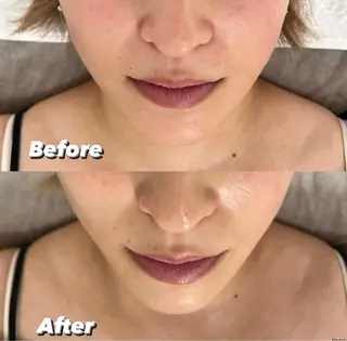 脱毛&Beauty salon IILA所属・垢抜けお手伝い💖 Sakuraの眉毛・アイブロウイメージ