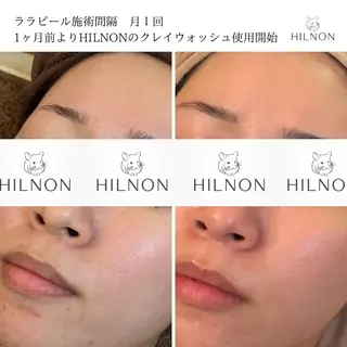 医療提携認定サロン　RUPO THE MAINTENANCE新潟店【ローマピンク/ララピール】所属・オーナー Nanjoのエステ・リラクイメージ