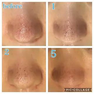 ロング カラー パーマ ヘアアレンジ メンズ キッズ ネイル マツエク・マツパ Ensor Clair所属・EnsorClair 代表 野口真央のエステ・リラクイメージ