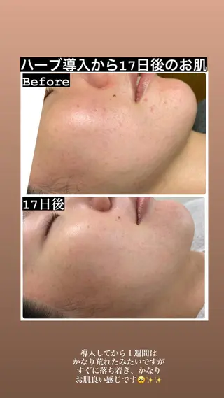 メンズ Natsu *メンズネイリストのネイルデザイン