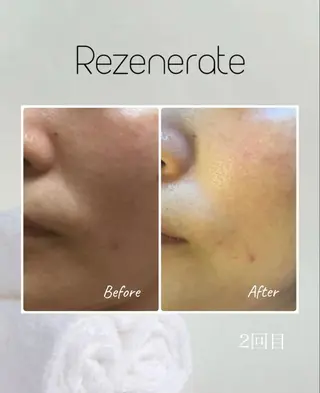 Ailes de Ange　MARIのエステ・リラクイメージ