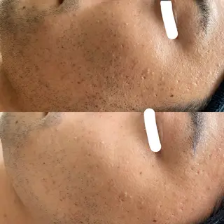 La BeIIe vie所属・LaBeIIevie ラベルヴィのマツエク・マツパデザイン