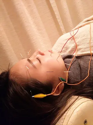 むくみたるみ専門☆ 美容鍼・小顔矯正のエステ・リラクイメージ