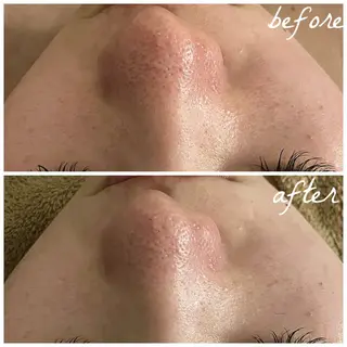 メンズ メナード岐阜茜部 杉浦のエステ・リラクイメージ