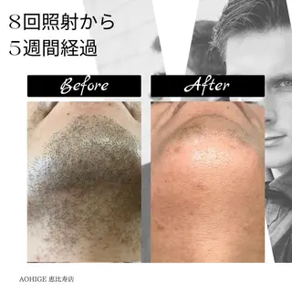 メンズ 【ena】 YUKOのマツエク・マツパデザイン