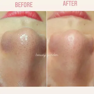 U_la所属・U_la [ウーラ] 片岡の眉毛・アイブロウイメージ