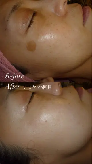 miyu 🩵のエステ・リラクイメージ