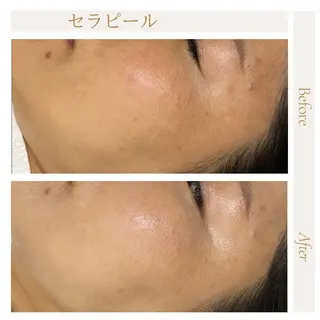 privatesalon icca所属・mana iccaのエステ・リラクイメージ
