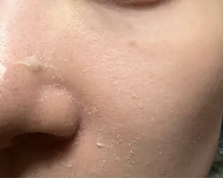 clé skin 🌿ハーブピーリングのエステ・リラクイメージ