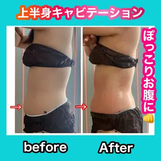 痩身/脱毛/ネイル HARUKAのエステ・リラクイメージ