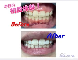 セルフホワイトニングサロン　ラヴィアン所属・ホワイトニングサロン La vie enのその他イメージ